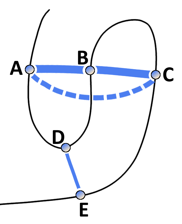 Effects of chained covariation obscure signals from true physical interactions. Consider residues A through E with physical interactions between the residue pairs A-B, B-C and D-E. The thickness of blue lines between residues reflects the strength of statistical dependencies between the corresponding alignment columns. Strong statistical dependencies between residue pairs (A,B) and (B,C) can induce a strong dependency between the spatially distant residues A and C. Covariation signals arising from transitive effects can become even stronger than other direct covariation signals and lead to false positive predictions.